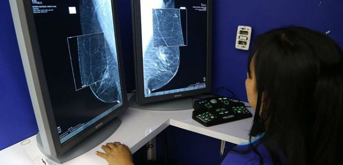Prevenir c�ncer de mama en Cali ser� m�s f�cil