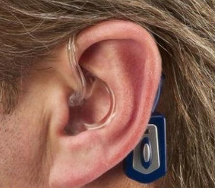 Entregar�n aud�fonos a 2.000 personas sordas